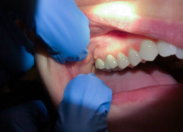 Best Orthodontic Emergency Dentist in Elmore, OH